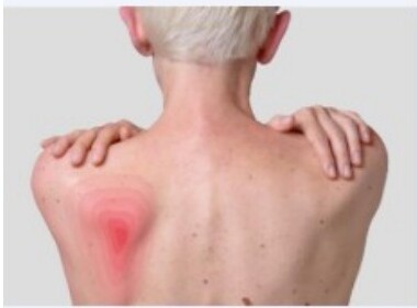 Skin and wound care education